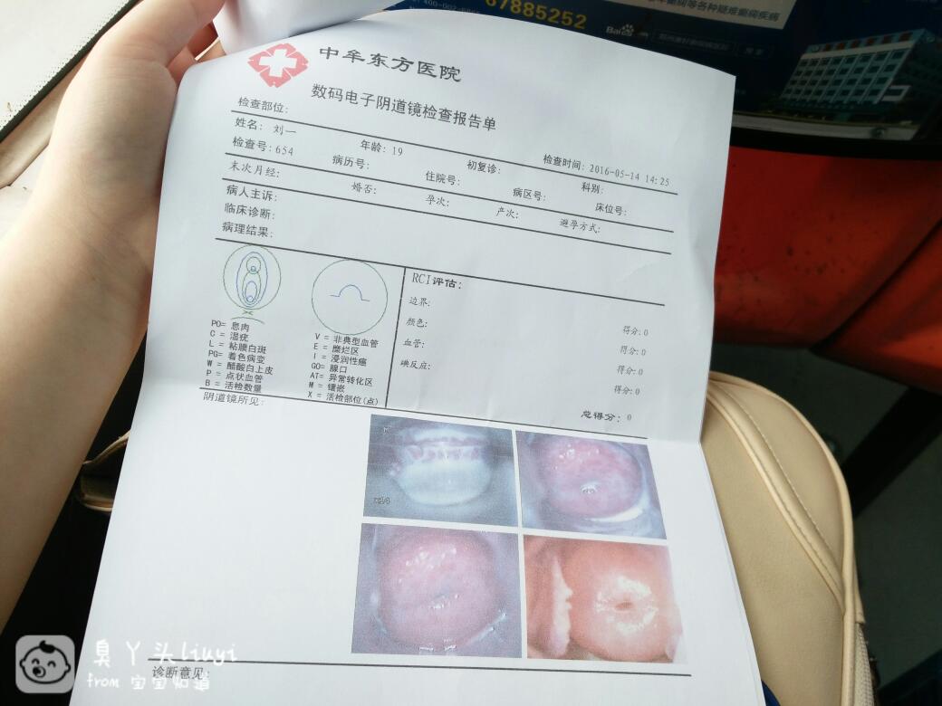 宫颈糜烂最新治疗手段