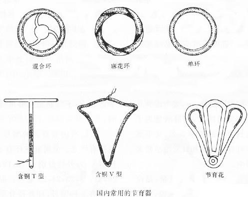 最新节育环图片欣赏，探索现代节育技术的魅力